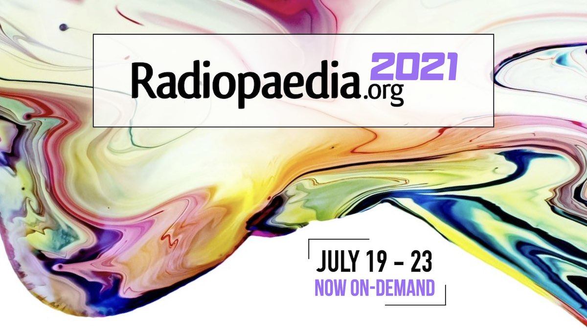 Radiopedia 2021 (July 19 – 23) (Videos, Well Organized)