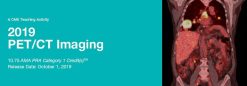 2019 PET CT Imaging A Video CME Teaching Activity | Medical Video Courses.