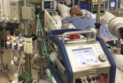 Adult ECLS Course – Innovative ECMO Concepts (Complete Contents) | Medical Video Courses.