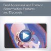 AIUM Fetal Abdominal and Thoracic Abnormalities: Features and Diagnosis | Medical Video Courses.
