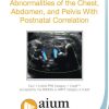AIUM Prenatal Ultrasound Abnormalities of the Chest