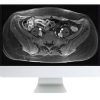ARRS A Guide to Bowel Imaging 2019 | Medical Video Courses.
