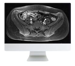 ARRS A Guide to Bowel Imaging 2019 | Medical Video Courses.