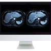 ARRS Abdominal and Pelvic MRI | Medical Video Courses.