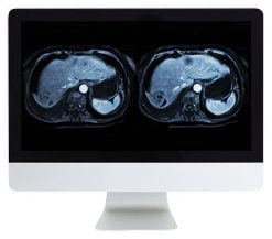 ARRS Abdominal and Pelvic MRI | Medical Video Courses.