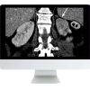 ARRS Abdominal and Thoracic Imaging Guidelines Applied: Evidence Versus Opinion 2021 | Medical Video Courses.