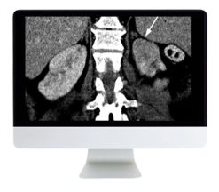 ARRS Abdominal and Thoracic Imaging Guidelines Applied: Evidence Versus Opinion 2021 | Medical Video Courses.