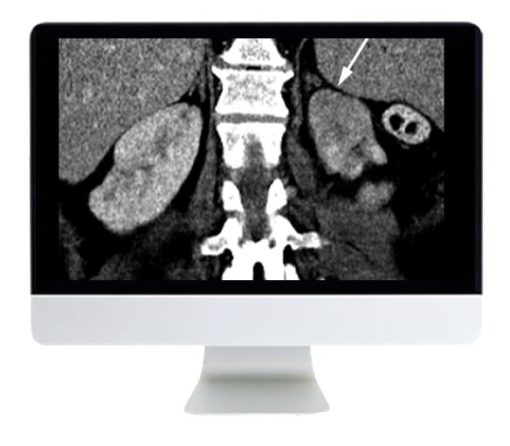 ARRS Abdominal and Thoracic Imaging Guidelines Applied: Evidence Versus Opinion 2021 | Medical Video Courses.