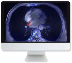 ARRS Applying Recent Advances in PET to Clinical Practice 2020 | Medical Video Courses.