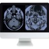 ARRS Artifacts and Physics in Daily Imaging A Case-Based Approach Online Course 2015 | Medical Video Courses.