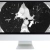 ARRS Basic Chest Imaging 2019 | Medical Video Courses.