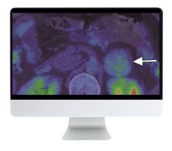ARRS Breakthroughs in Nuclear Medicine for Neurology and Oncology 2021