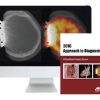 ARRS Case-Based Imaging Review 2016 | Medical Video Courses.