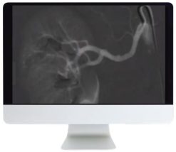ARRS Case-Based Subspecialty Review 2021 | Medical Video Courses.