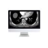ARRS Clinical Cardiopulmonary Imaging Review 2018 | Medical Video Courses.