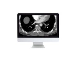 ARRS Clinical Cardiopulmonary Imaging Review 2018 | Medical Video Courses.