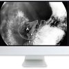 ARRS Clinical Case-Based Review of Abdominal Imaging 2019 | Medical Video Courses.