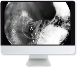 ARRS Clinical Case-Based Review of Abdominal Imaging 2019 | Medical Video Courses.