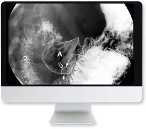 ARRS Clinical Case-Based Review of Abdominal Imaging 2019 | Medical Video Courses.