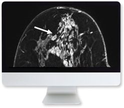 ARRS Clinical Case-Based Review of Breast Imaging 2019 | Medical Video Courses.