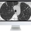 ARRS Clinical Case-Based Review of Cardiopulmonary Imaging 2019 | Medical Video Courses.