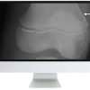 ARRS Clinical Case-Based Review of Musculoskeletal Imaging 2019 | Medical Video Courses.