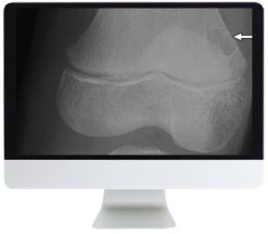 ARRS Clinical Case-Based Review of Musculoskeletal Imaging 2019 | Medical Video Courses.