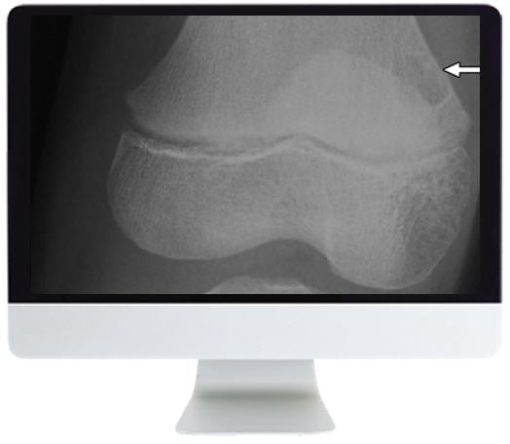 ARRS Clinical Case-Based Review of Musculoskeletal Imaging 2019 | Medical Video Courses.
