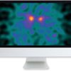 ARRS Clinical Case-Based Review of Nuclear Medicine 2019 | Medical Video Courses.