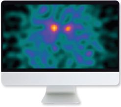ARRS Clinical Case-Based Review of Nuclear Medicine 2019 | Medical Video Courses.
