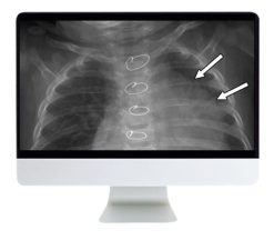 ARRS Clinical Case-Based Review of Pediatric Imaging 2019 | Medical Video Courses.