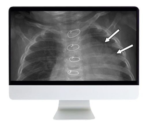 ARRS Clinical Case-Based Review of Pediatric Imaging 2019 | Medical Video Courses.