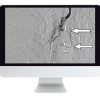 ARRS Clinical Case-Based Review of Vascular and Interventional Imaging 2019 | Medical Video Courses.