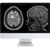 ARRS Clinical Pediatric Imaging Review 2017 | Medical Video Courses.