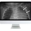 ARRS Clinical Pediatric Imaging Review 2019 | Medical Video Courses.