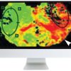ARRS Code Stroke: What the Radiologist Needs to Know in the Changing Landscape of Acute Ischemic Stroke 2019 | Medical Video Courses.