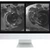 ARRS Controversies in Hip and Pelvis Imaging | Medical Video Courses.