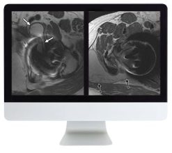 ARRS Controversies in Hip and Pelvis Imaging | Medical Video Courses.