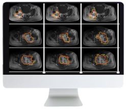 ARRS Crossroads of Computational Science and Musculoskeletal Imaging: Where Machine Magic Can Aid Radiologists 2021