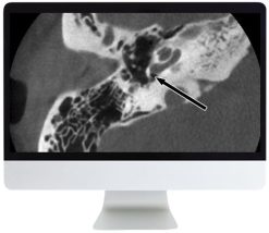 ARRS Deep Dive into Head and Neck Radiology 2020 | Medical Video Courses.