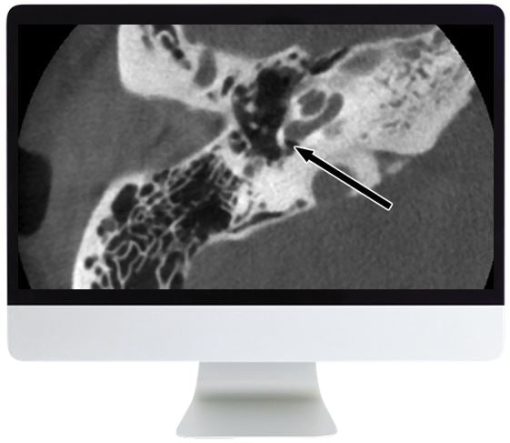 ARRS Deep Dive into Head and Neck Radiology 2020 | Medical Video Courses.