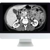 ARRS Gastrointestinal Imaging 2019 | Medical Video Courses.