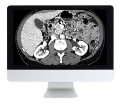 ARRS Gastrointestinal Imaging 2019 | Medical Video Courses.