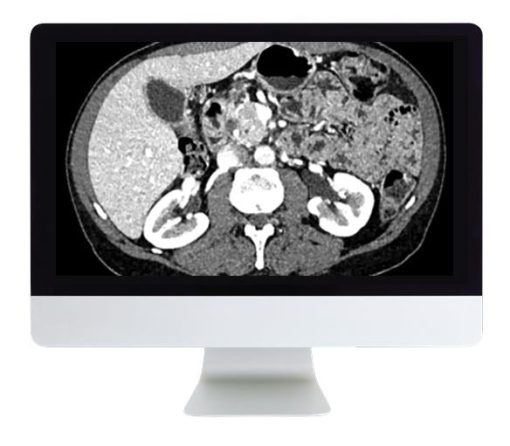 ARRS Gastrointestinal Imaging 2019 | Medical Video Courses.