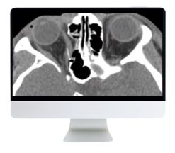 ARRS Imaging Victims of Violence Fists, Stabs, Bullets, and Blasts 2021