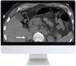 ARRS Male Genitourinary Imaging: From Anatomy to Oncology 2018 | Medical Video Courses.