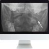 ARRS Neuroradiology Review for the Practicing Radiologist 2018 | Medical Video Courses.