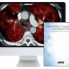 ARRS Practical Dual-Energy CT Throughout the Body 2021 | Medical Video Courses.