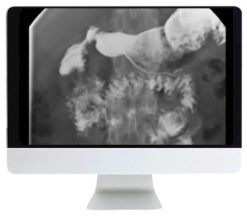 ARRS Practical Pediatric Imaging 2021