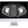 ARRS Radiologic Reasoning A Rapid Fire Multispecialty Review 2018 | Medical Video Courses.